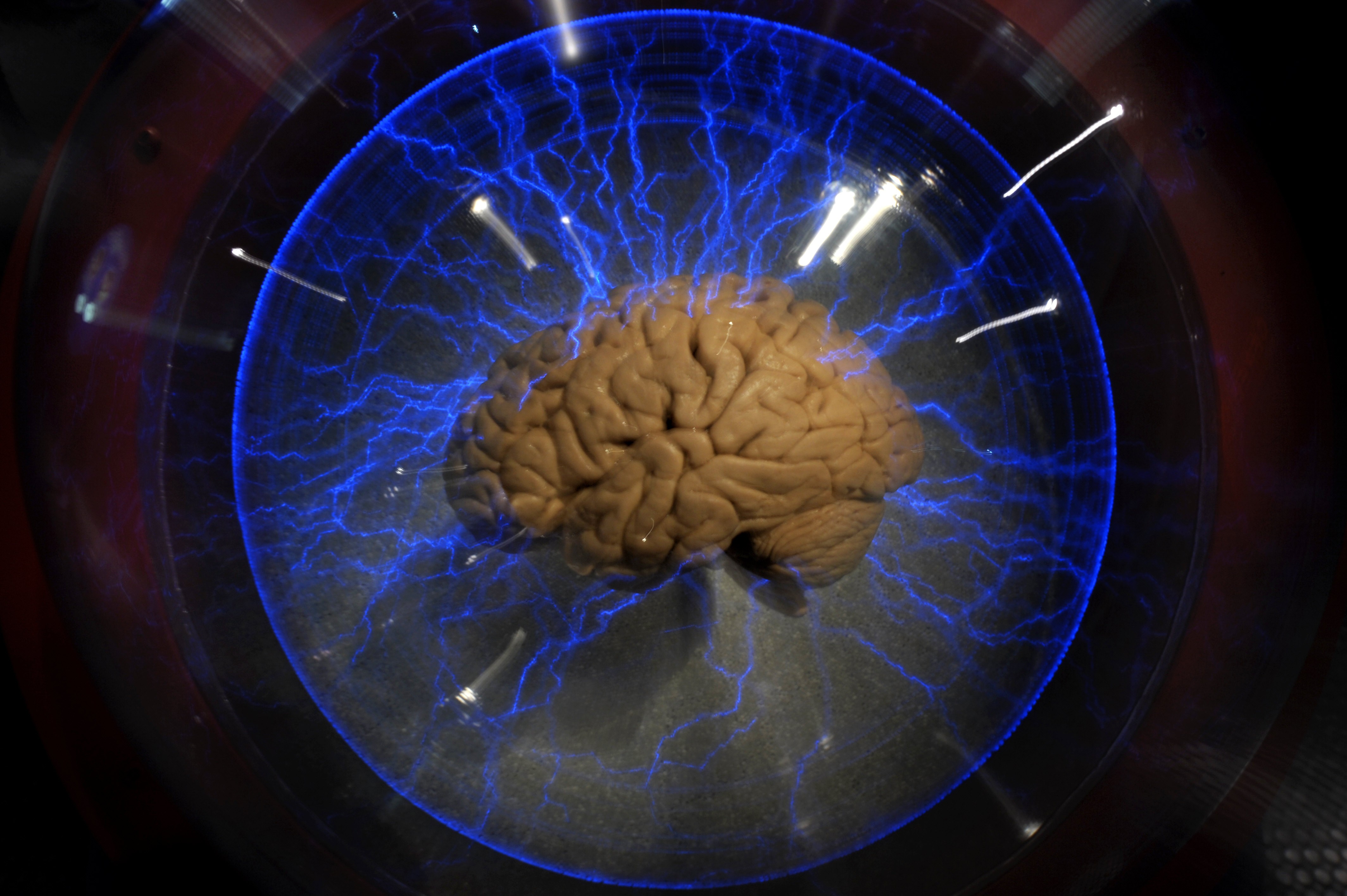 An actual human brain displayed inside a glass box, as part of an interactive exhibition "Brain: a world inside your head", in Sao Paulo, Brazil, on August 21, 2009. The exhibition, which presents on interactive installations how functions and physiology of the brain are developed since childhood until old age, runs until 25 October. AFP PHOTO/Mauricio LIMA (Photo credit should read MAURICIO LIMA/AFP/Getty Images)