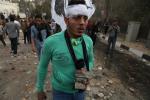 A wounded Egyptian protester carries stones during clashes between supporters and opponents of Egypt’s powerful Muslim Brotherhood near the Islamist group’s Cairo, Egypt headquarters Friday, March 22, 2013.