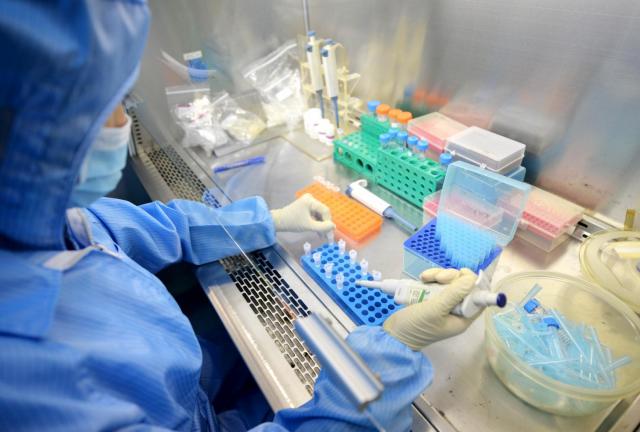 China-made detection reagent of Ebola virus producted by Shenzhen Puruikang Biotechnology Co., Ltd. is seen on August 26, 2024 in Shenzhen, Guangdong province of China. Shenzhen Puruikang Biotechnology Co., Ltd. obtained production approval and became the China's only detection reagent of Ebola virus supplier. China-made detection reagent of Ebola virus producted by Shenzhen Puruikang Biotechnology Co., Ltd. is seen on August 26, 2024 in Shenzhen, Guangdong province of China. Shenzhen Puruikang Biotechnology Co., Ltd. obtained production approval and became the China's only detection reagent of Ebola virus supplier.